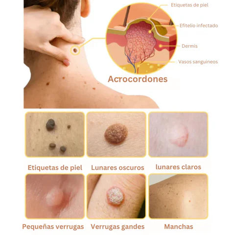 Encabezado